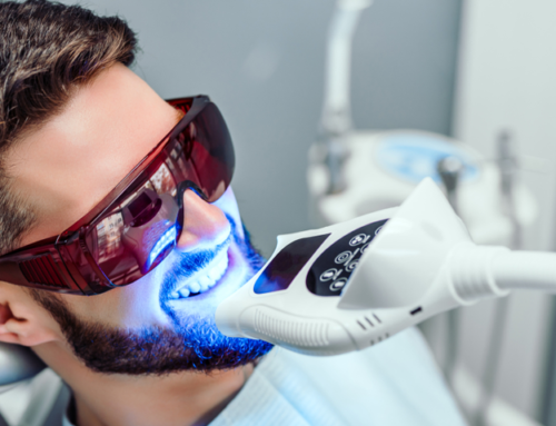 Teeth Whitening dental services in Calgary