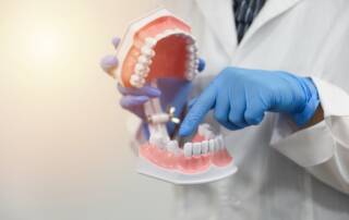Treatment for Missing Teeth