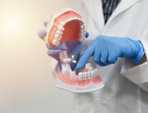 One of The Most Effective Dental Services for Missing Teeth