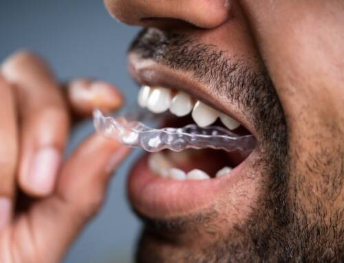 Teeth Alignment Services in Calgary: Is Invisalign Right for You?