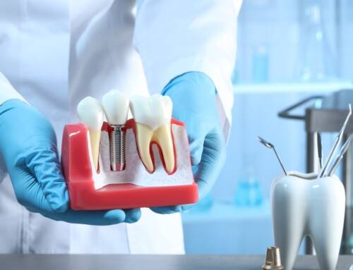 Dentures vs Dental Implants: Which One is Right for You