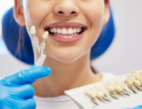 How Often Do You Need a Dental Cleaning? Considering Factors You Should Know