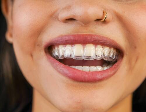 6 Easy Tips on How to Clean Dental Retainers the Right Way