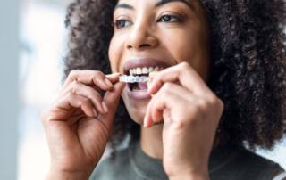 Invisalign Cost in Calgary