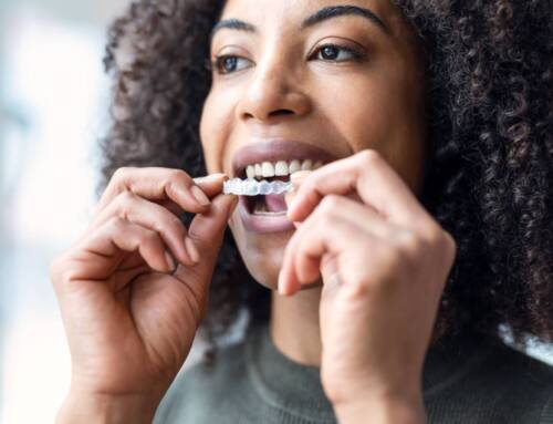 Invisalign Cost in Calgary: Prices, Factors, Financing