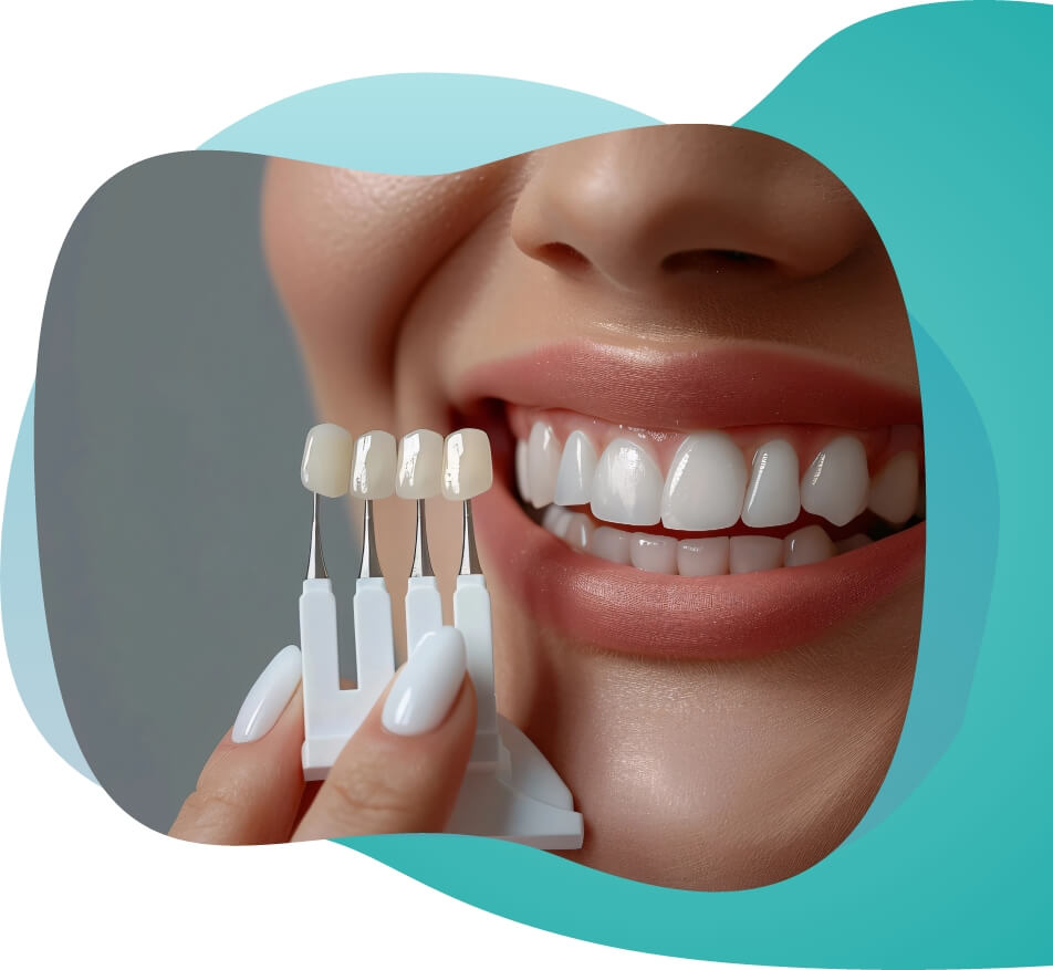 Brighter smile image